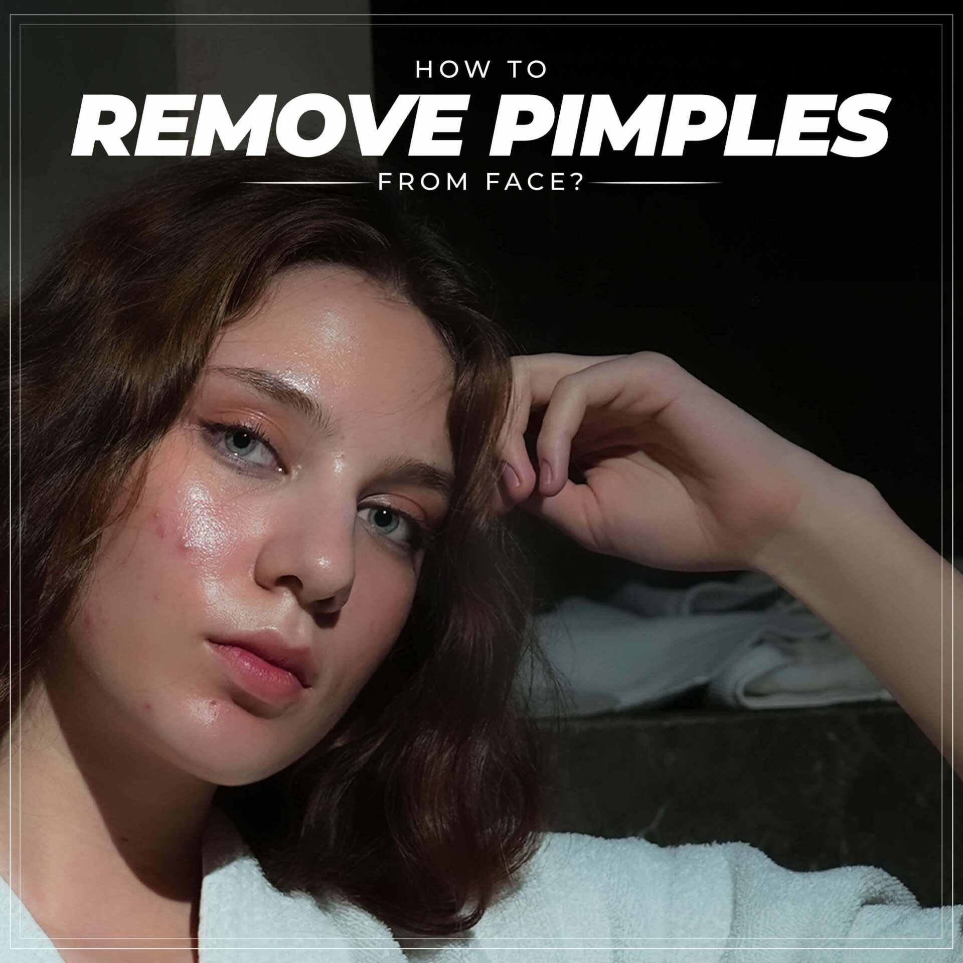 How Do I Remove Pimples from My Face?