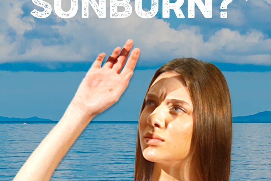 What Happens to Your Skin When You Get a Sunburn