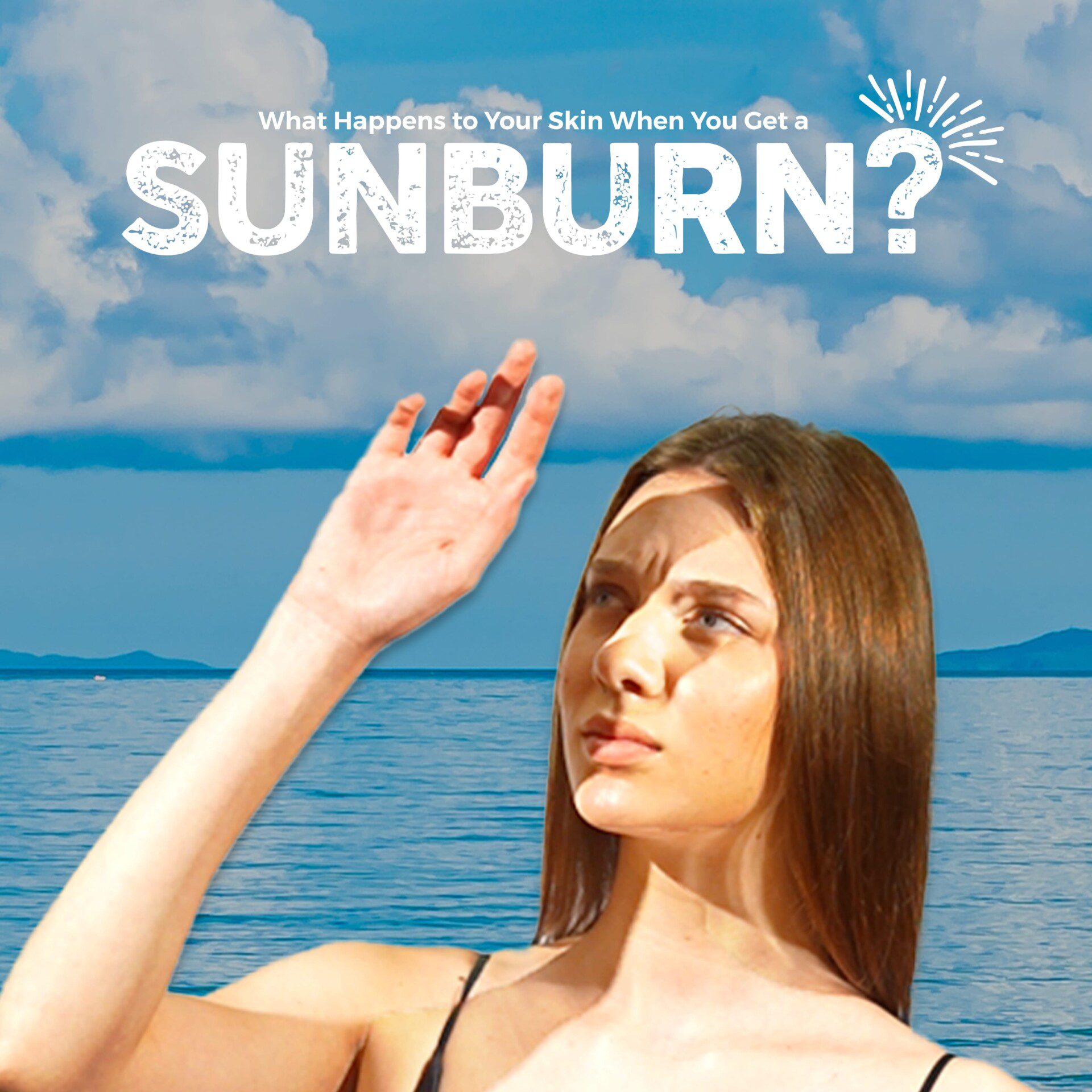 What Happens to Your Skin When You Get a Sunburn