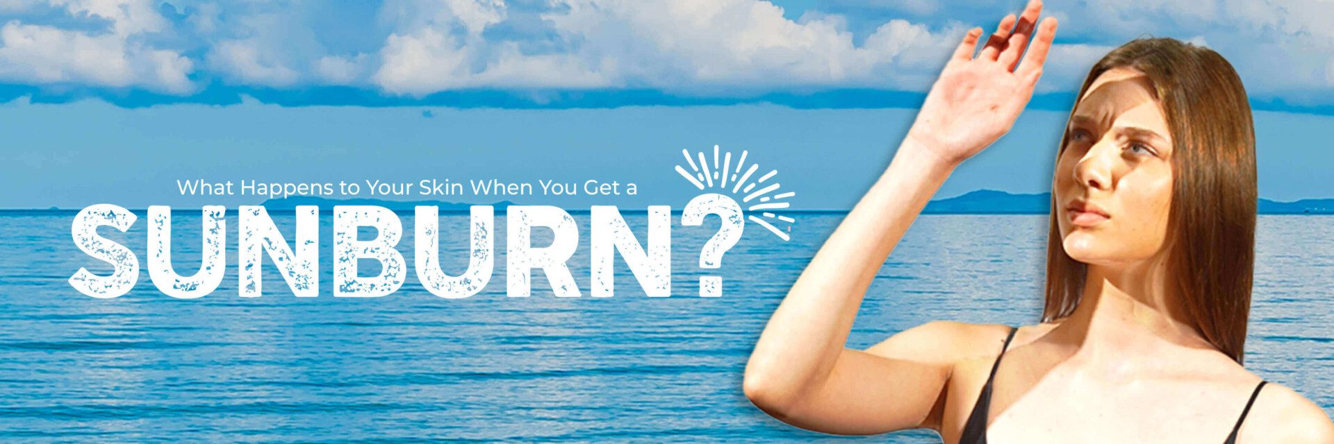 What Happens to Your Skin When You Get a Sunburn 